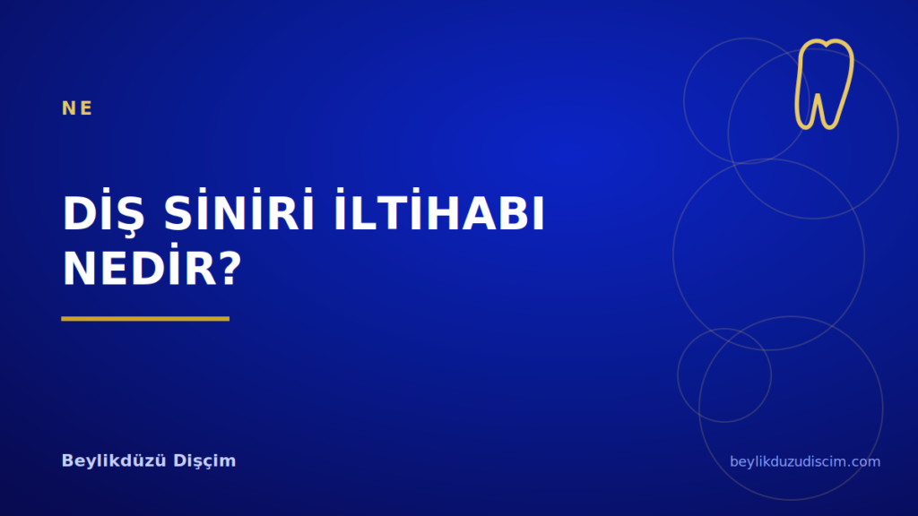 Diş Siniri İltihabı Nedir?