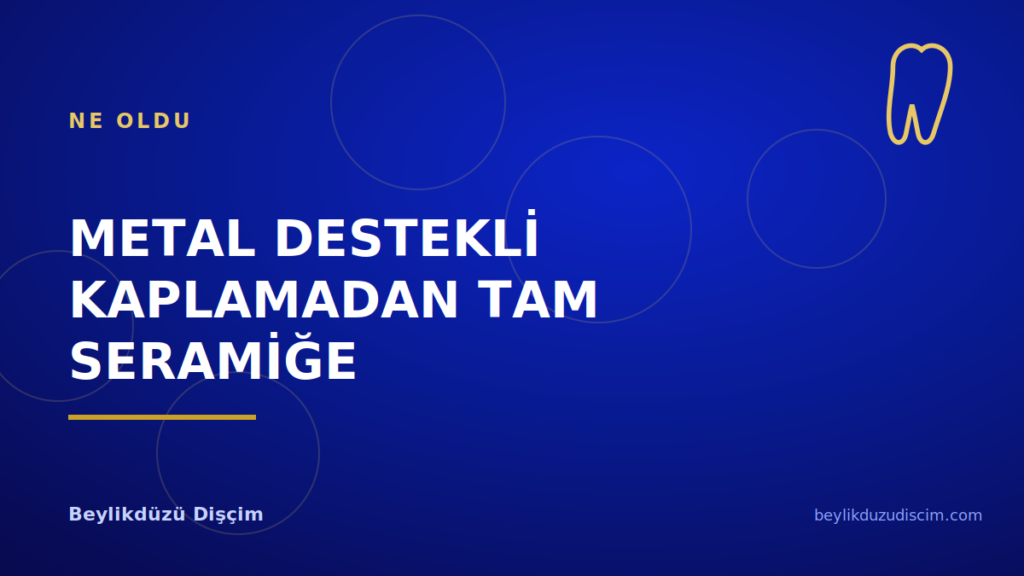 Metal Destekli Kaplamadan Tam Seramiğe: Ne Değişti?